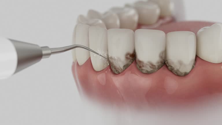 Reliable Dental Implants contractor in Chatmoss, VA by Smile Center Dentistry